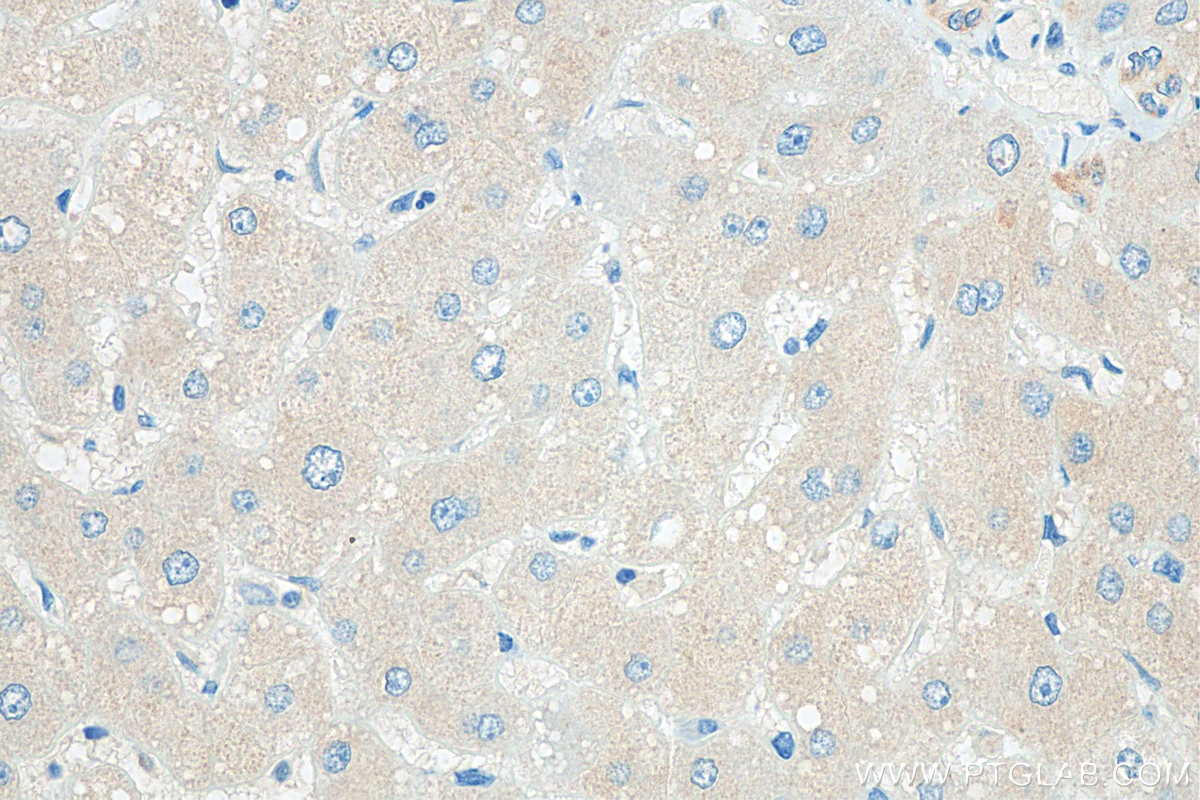 IHC staining of human liver using 11329-2-AP