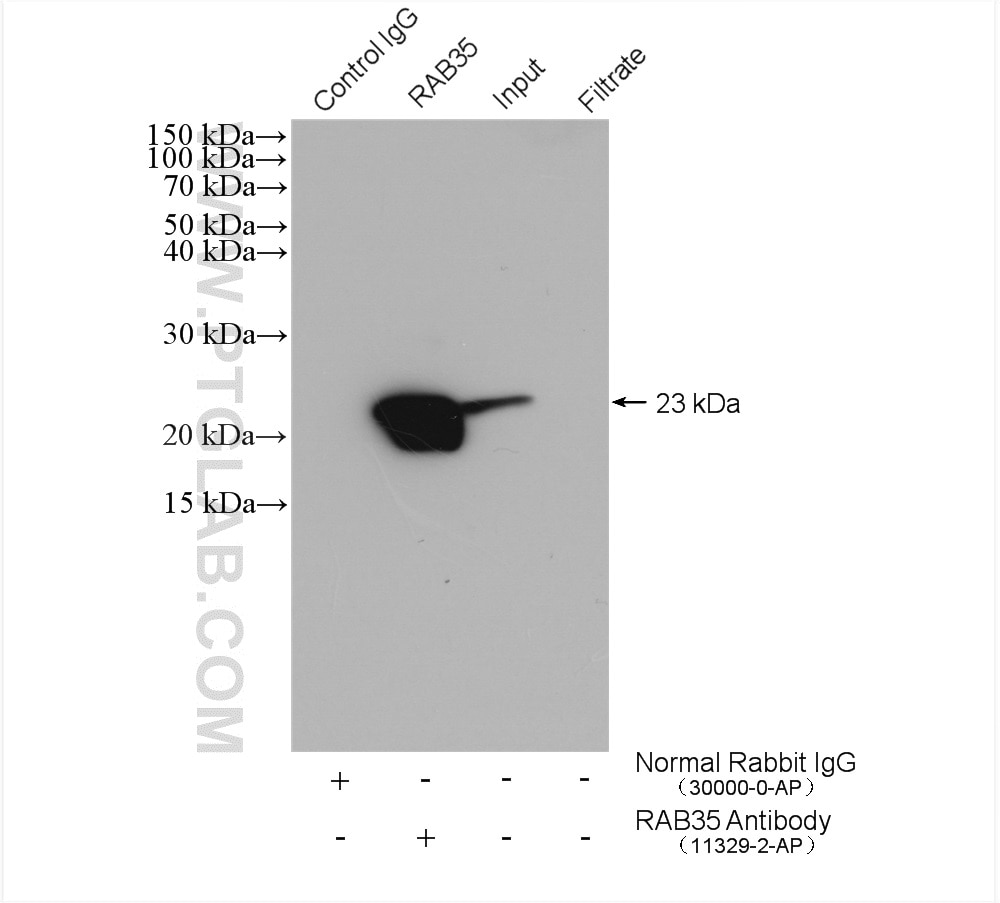 Immunoprecipitation (IP) experiment of mouse brain tissue using RAB35 Polyclonal antibody (11329-2-AP)