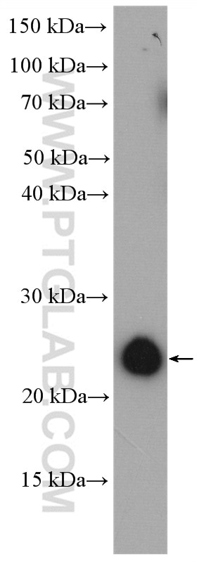Western Blot (WB) analysis of MCF-7 cells using RAB35 Polyclonal antibody (11329-2-AP)