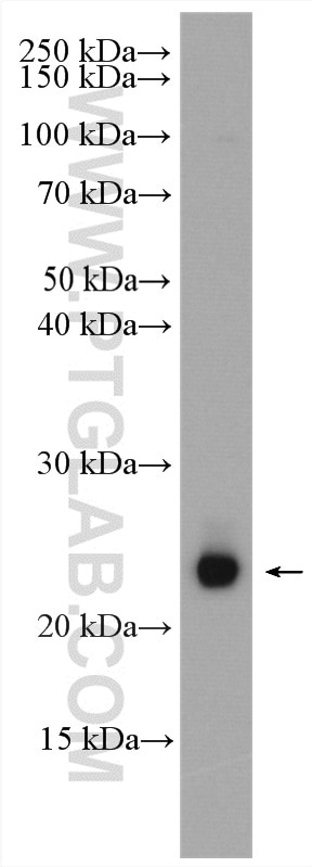 WB analysis of RAW 264.7 using 11329-2-AP