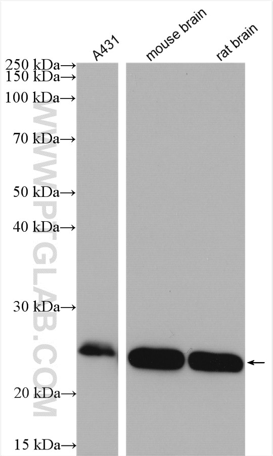 Western Blot (WB) analysis of various lysates using RAB35 Polyclonal antibody (11329-2-AP)