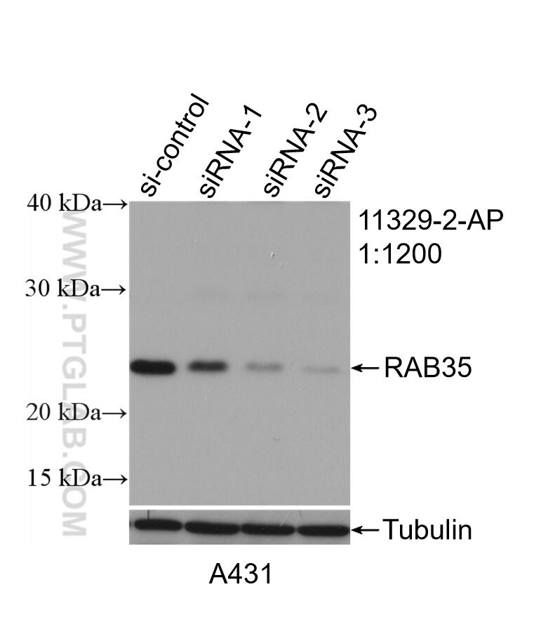 Western Blot (WB) analysis of A431 cells using RAB35 Polyclonal antibody (11329-2-AP)