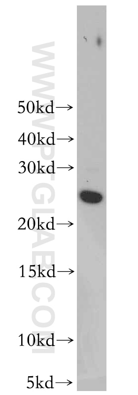 Western Blot (WB) analysis of human brain tissue using RAB35 Polyclonal antibody (11329-2-AP)