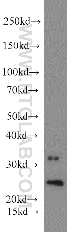 Western Blot (WB) analysis of A375 cells using RAB35 Polyclonal antibody (11329-2-AP)