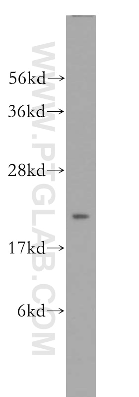 Western Blot (WB) analysis of HeLa cells using RAB35 Polyclonal antibody (11329-2-AP)