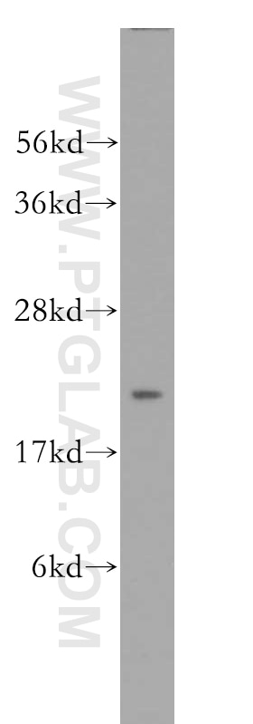 WB analysis of HeLa using 11329-2-AP