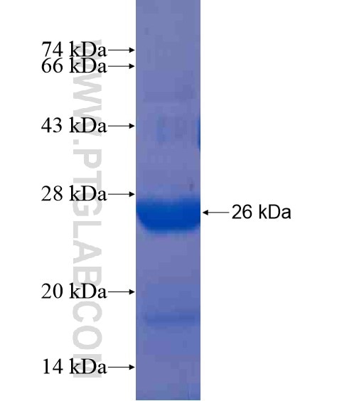 RAB35 fusion protein Ag21424 SDS-PAGE