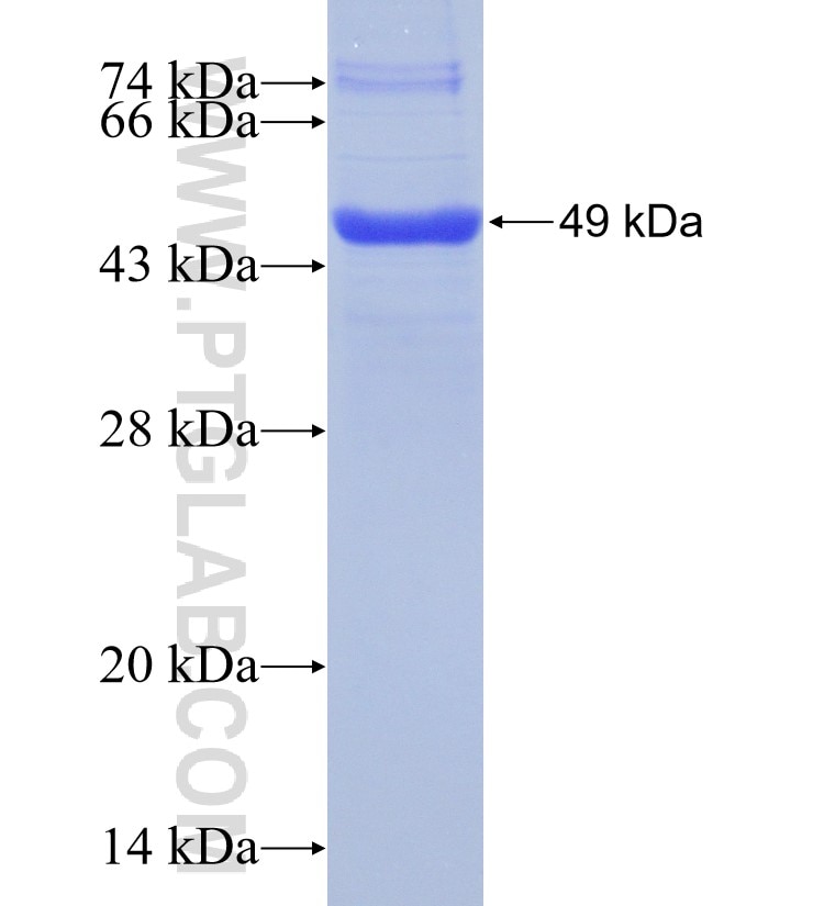 RAB35 fusion protein Ag1872 SDS-PAGE
