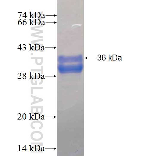 RAB36 fusion protein Ag24921 SDS-PAGE