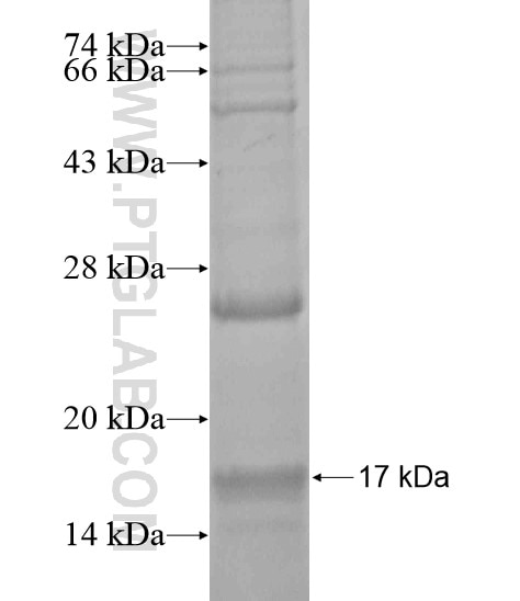 RAB36 fusion protein Ag20007 SDS-PAGE