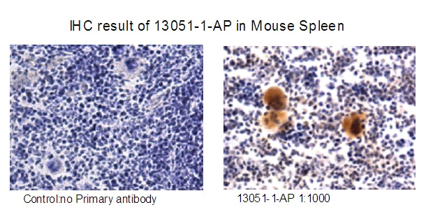 Immunohistochemistry (IHC) staining of mouse spleen tissue using RAB37 Polyclonal antibody (13051-1-AP)