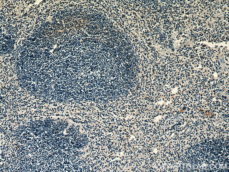 Immunohistochemistry (IHC) staining of mouse spleen tissue using RAB37 Polyclonal antibody (13051-1-AP)