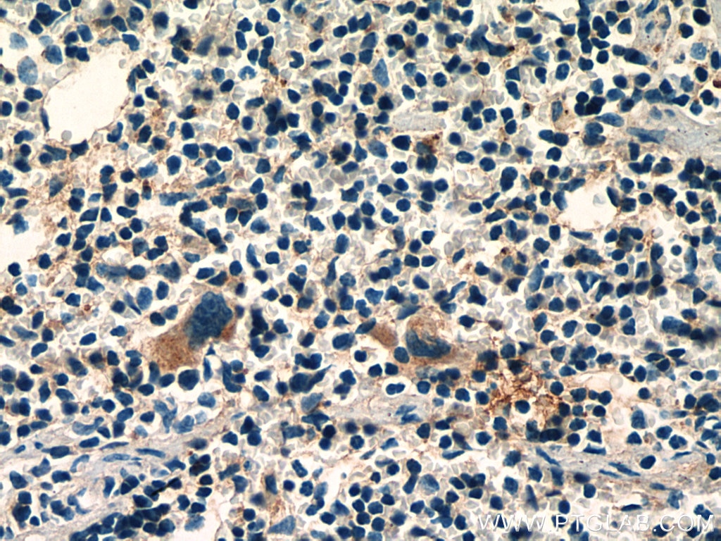 Immunohistochemistry (IHC) staining of mouse spleen tissue using RAB37 Polyclonal antibody (13051-1-AP)