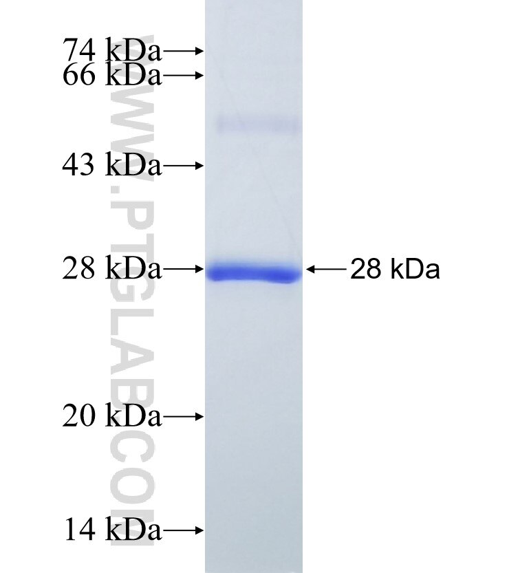 RAB37 fusion protein Ag14655 SDS-PAGE