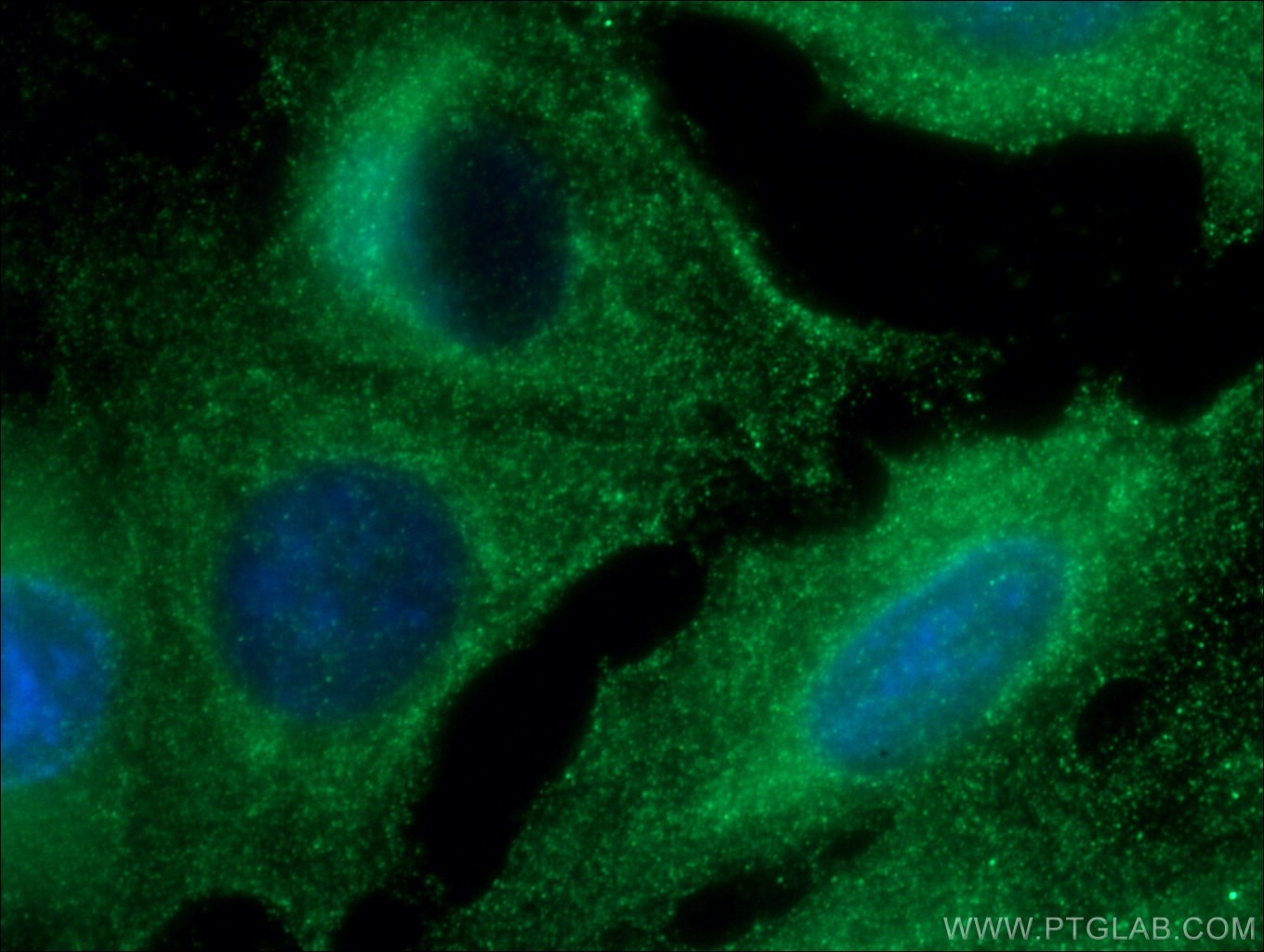 Immunofluorescence (IF) / fluorescent staining of A549 cells using RAB38 Polyclonal antibody (12234-1-AP)