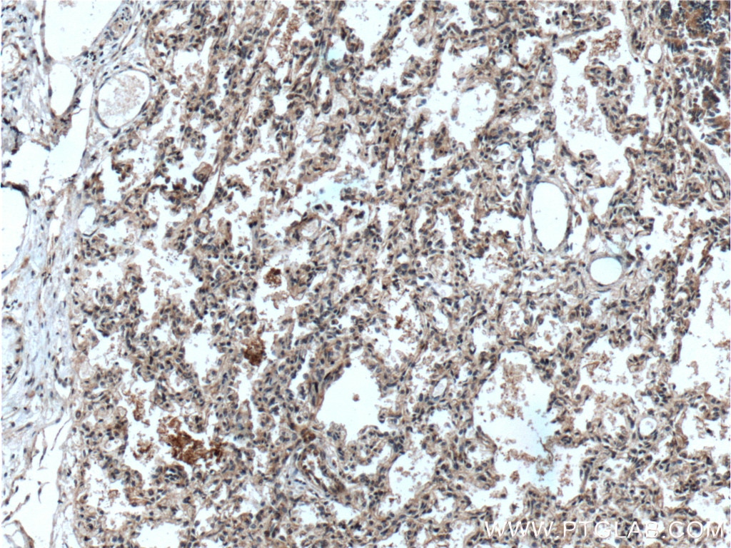 Immunohistochemistry (IHC) staining of human lung tissue using RAB38 Polyclonal antibody (12234-1-AP)