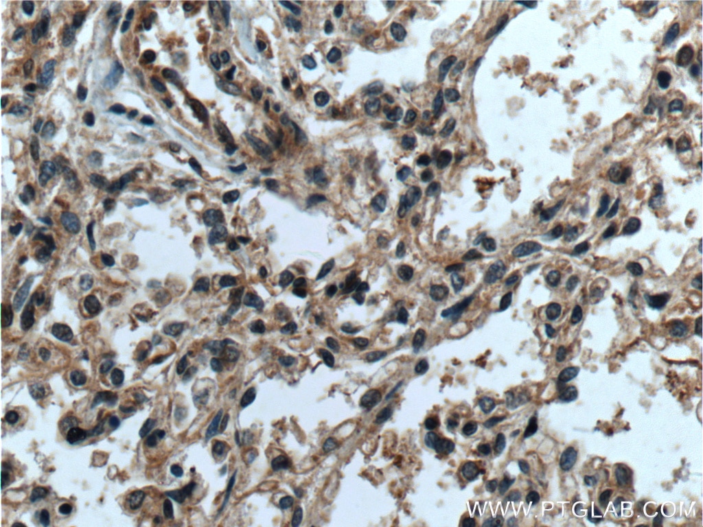 Immunohistochemistry (IHC) staining of human lung tissue using RAB38 Polyclonal antibody (12234-1-AP)