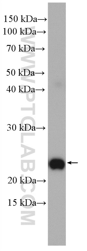 Western Blot (WB) analysis of A375 cells using RAB38 Polyclonal antibody (12234-1-AP)
