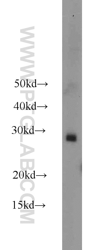 Western Blot (WB) analysis of NIH/3T3 cells using RAB38 Polyclonal antibody (12234-1-AP)