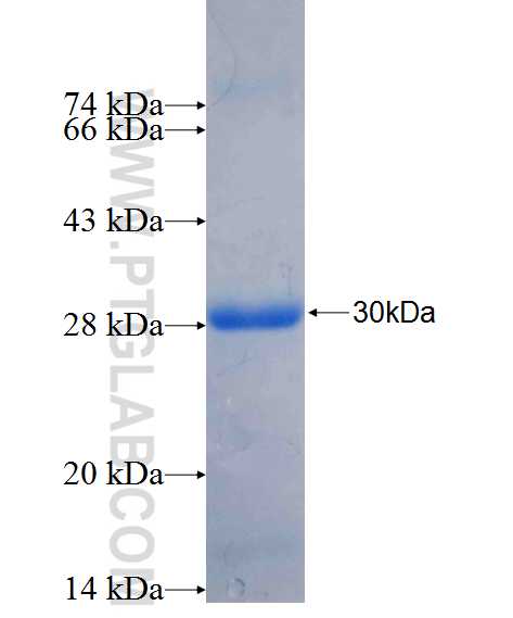 RAB38 fusion protein Ag26440 SDS-PAGE