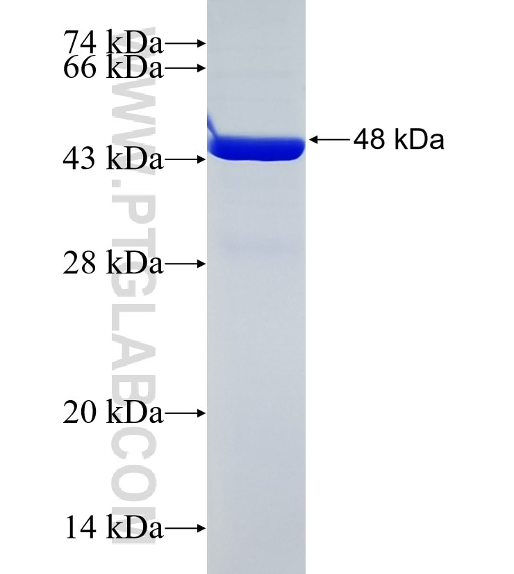 RAB38 fusion protein Ag2874 SDS-PAGE