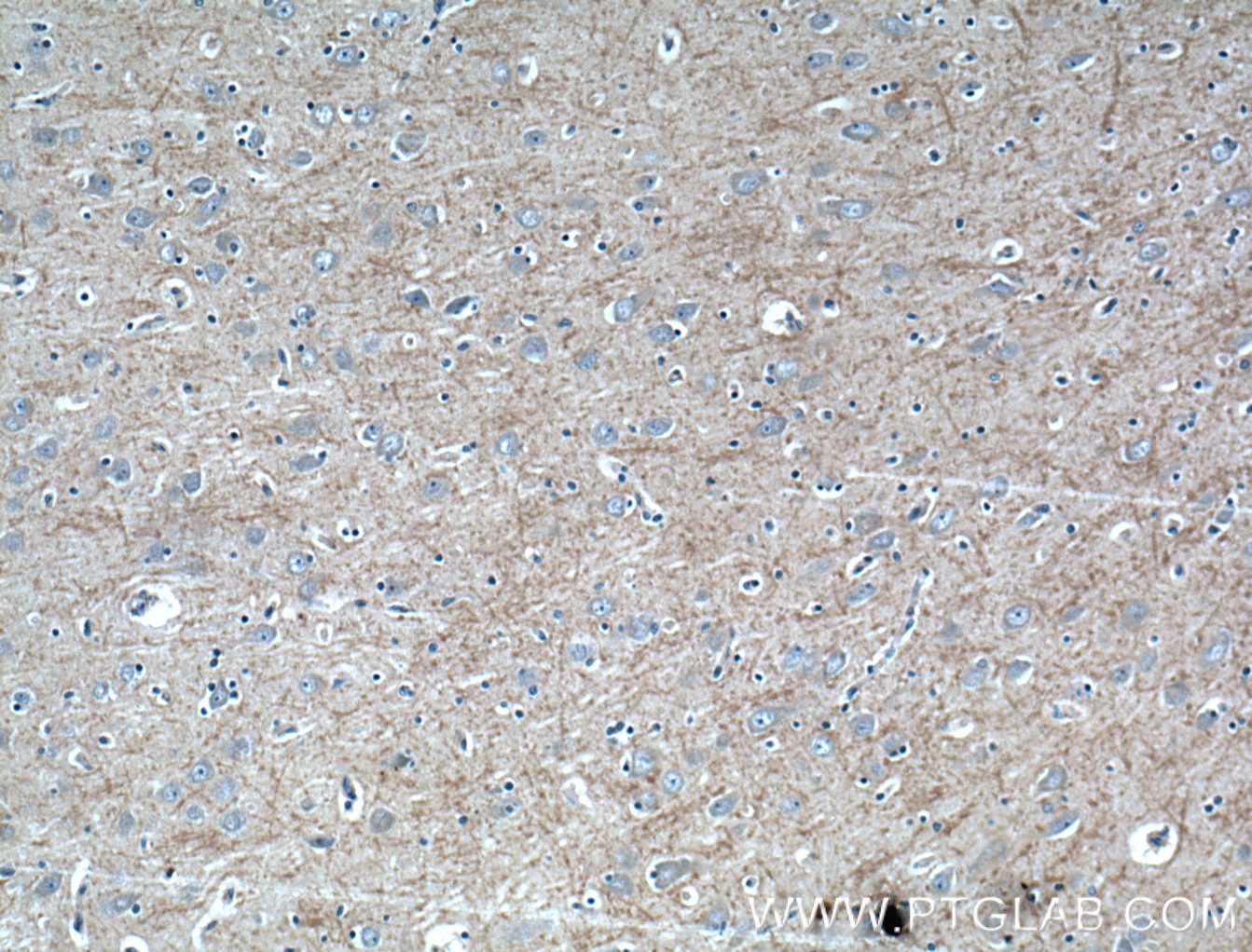 Immunohistochemistry (IHC) staining of human brain tissue using RAB39 Polyclonal antibody (13355-1-AP)