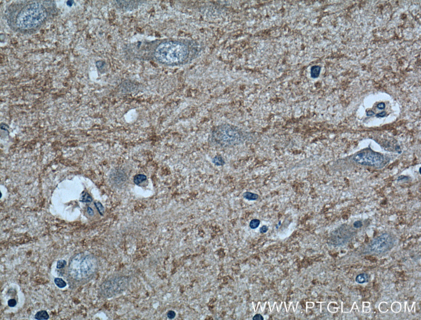 Immunohistochemistry (IHC) staining of human brain tissue using RAB39 Polyclonal antibody (13355-1-AP)