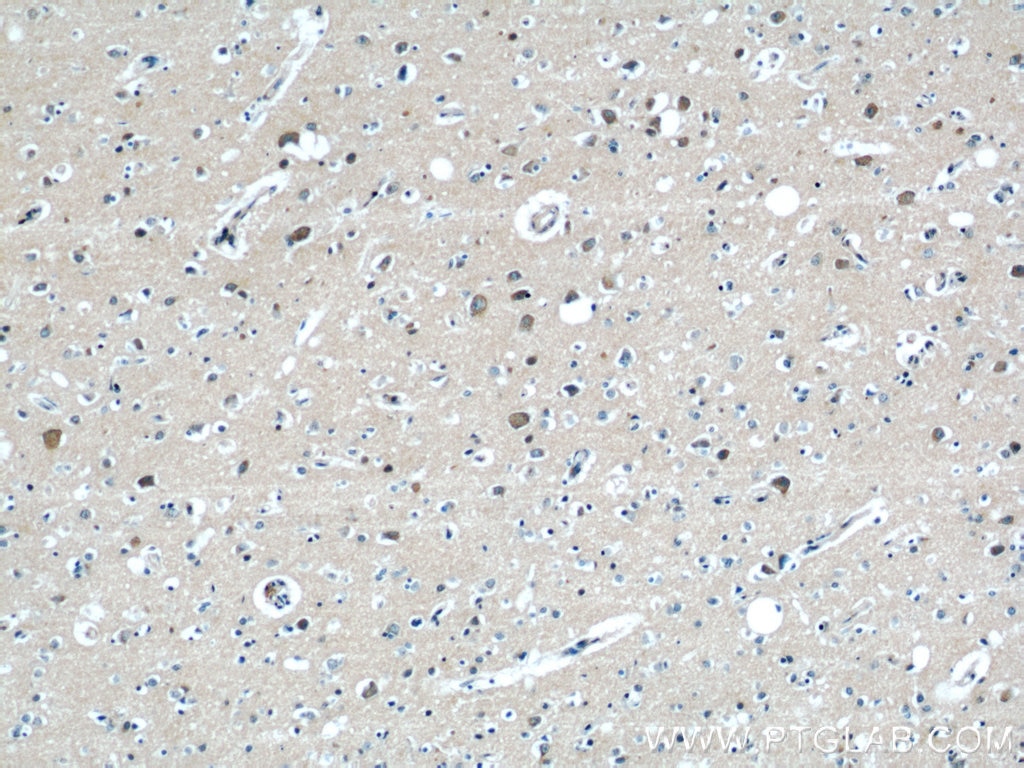 Immunohistochemistry (IHC) staining of human brain tissue using RAB39 Polyclonal antibody (13355-1-AP)