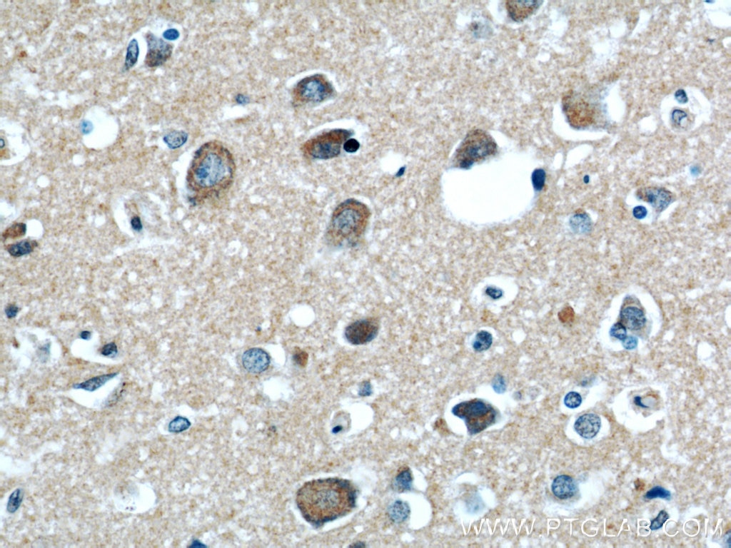 Immunohistochemistry (IHC) staining of human brain tissue using RAB39 Polyclonal antibody (13355-1-AP)