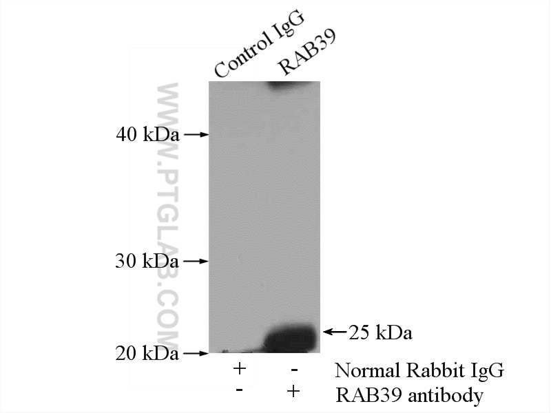 Immunoprecipitation (IP) experiment of mouse brain tissue using RAB39 Polyclonal antibody (13355-1-AP)