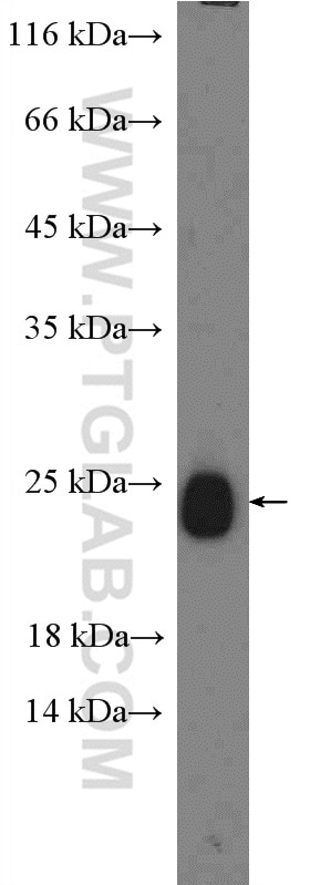 Western Blot (WB) analysis of mouse brain tissue using RAB39 Polyclonal antibody (13355-1-AP)