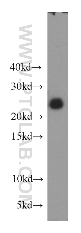 Western Blot (WB) analysis of human brain tissue using RAB39 Polyclonal antibody (13355-1-AP)