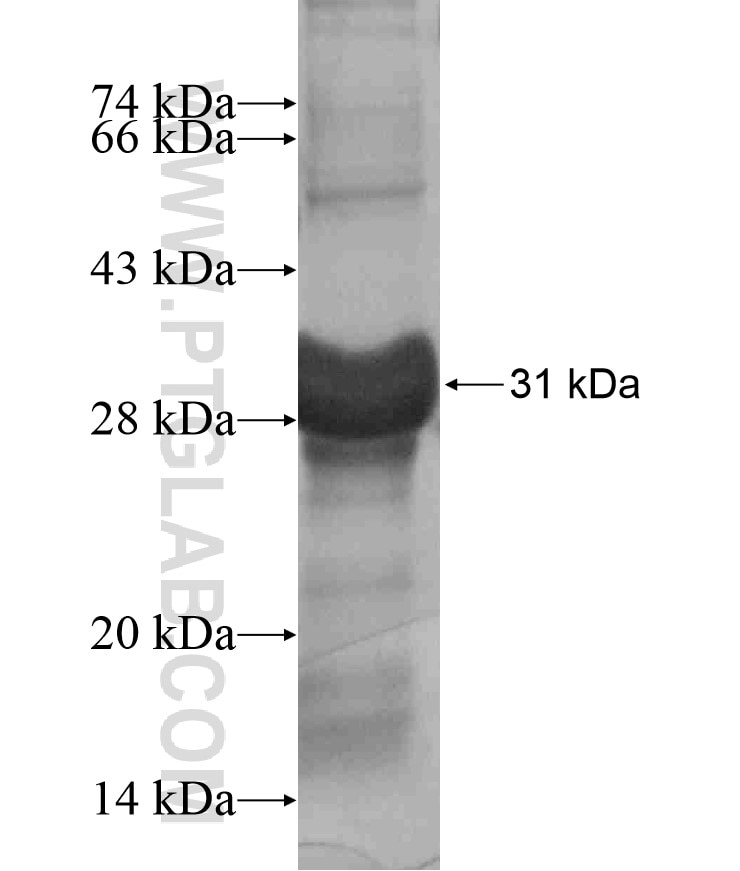 RAB39 fusion protein Ag17876 SDS-PAGE