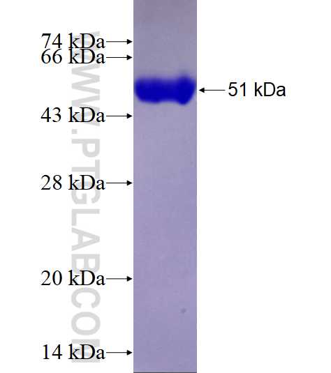 RAB39 fusion protein Ag4151 SDS-PAGE