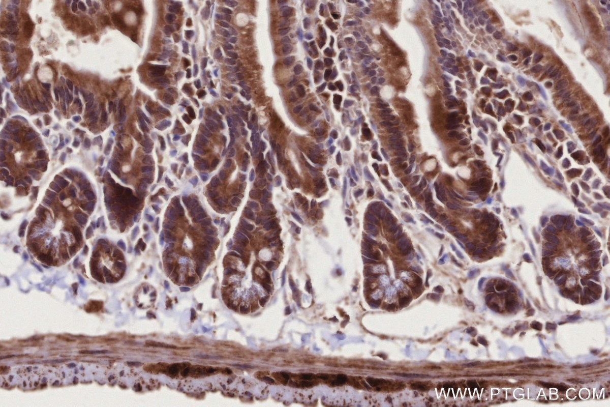 Immunohistochemistry (IHC) staining of mouse small intestine tissue using RAB39B Polyclonal antibody (12162-1-AP)