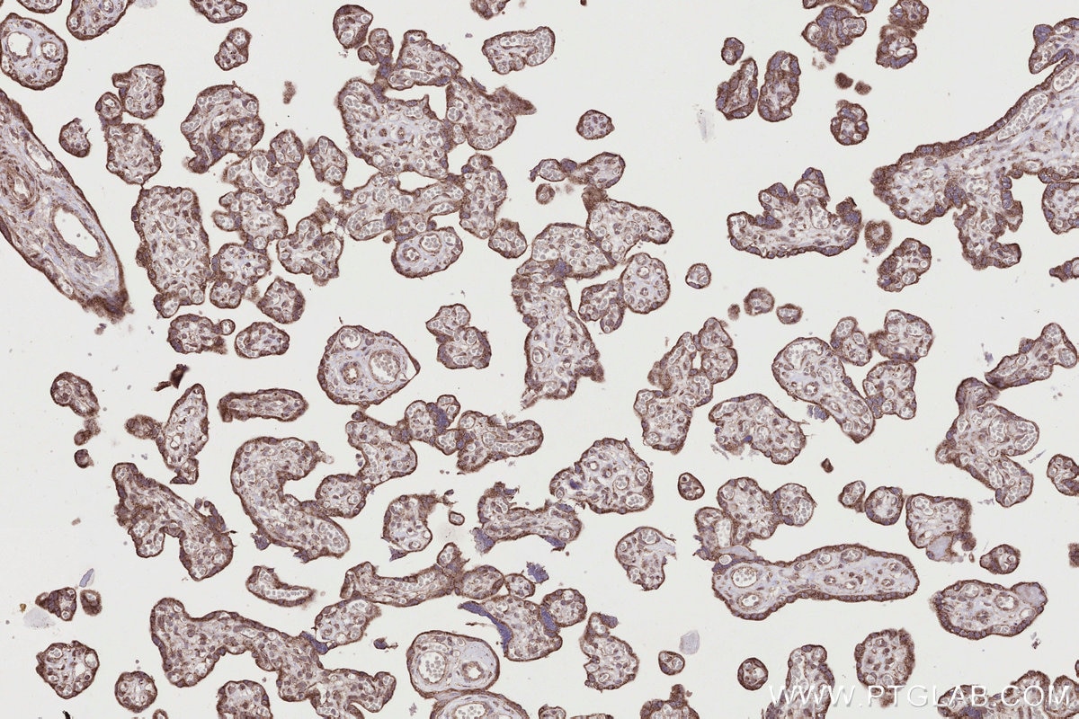 Immunohistochemistry (IHC) staining of human placenta tissue using RAB39B Polyclonal antibody (12162-1-AP)
