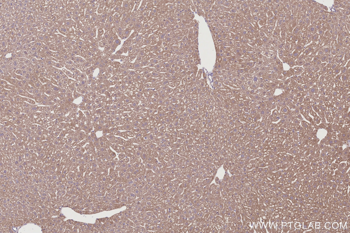 Immunohistochemistry (IHC) staining of mouse liver tissue using RAB39B Polyclonal antibody (12162-1-AP)