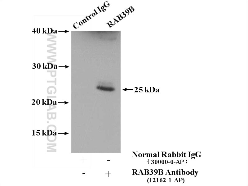 Immunoprecipitation (IP) experiment of SH-SY5Y cells using RAB39B Polyclonal antibody (12162-1-AP)