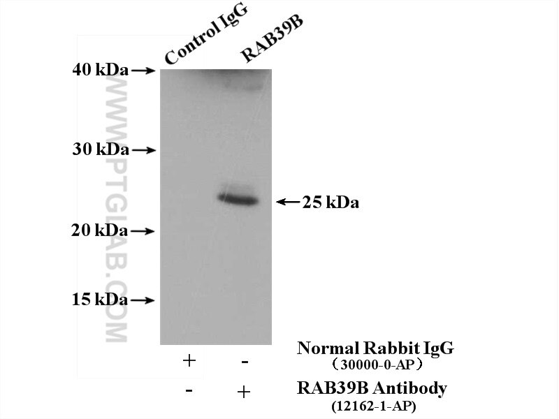 IP experiment of SH-SY5Y using 12162-1-AP