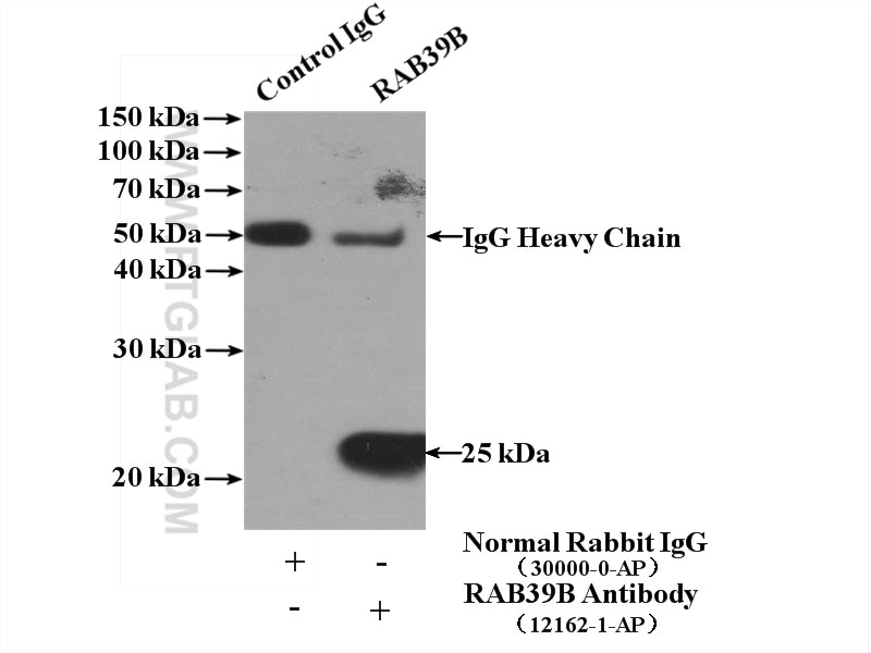 Immunoprecipitation (IP) experiment of mouse brain tissue using RAB39B Polyclonal antibody (12162-1-AP)