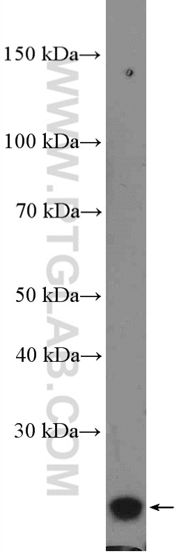 Western Blot (WB) analysis of Y79 cells using RAB39B Polyclonal antibody (12162-1-AP)