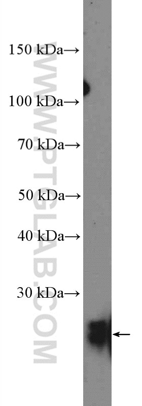 Western Blot (WB) analysis of Y79 cells using RAB39B Polyclonal antibody (12162-1-AP)