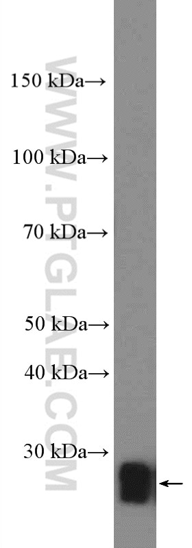 Western Blot (WB) analysis of fetal human brain tissue using RAB39B Polyclonal antibody (12162-1-AP)
