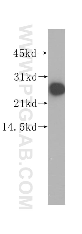 Western Blot (WB) analysis of human brain tissue using RAB39B Polyclonal antibody (12162-1-AP)