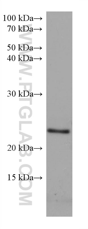 Western Blot (WB) analysis of LNCaP cells using RAB39B Monoclonal antibody (68014-1-Ig)