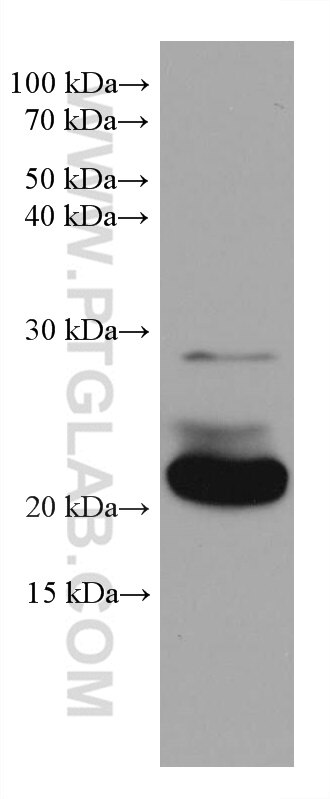 Western Blot (WB) analysis of rabbit brain tissue using RAB39B Monoclonal antibody (68014-1-Ig)