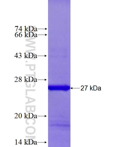 RAB39B fusion protein Ag27170 SDS-PAGE