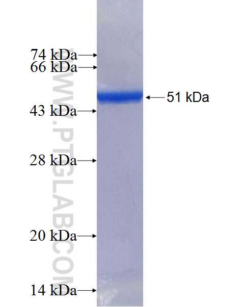 RAB39B fusion protein Ag2803 SDS-PAGE