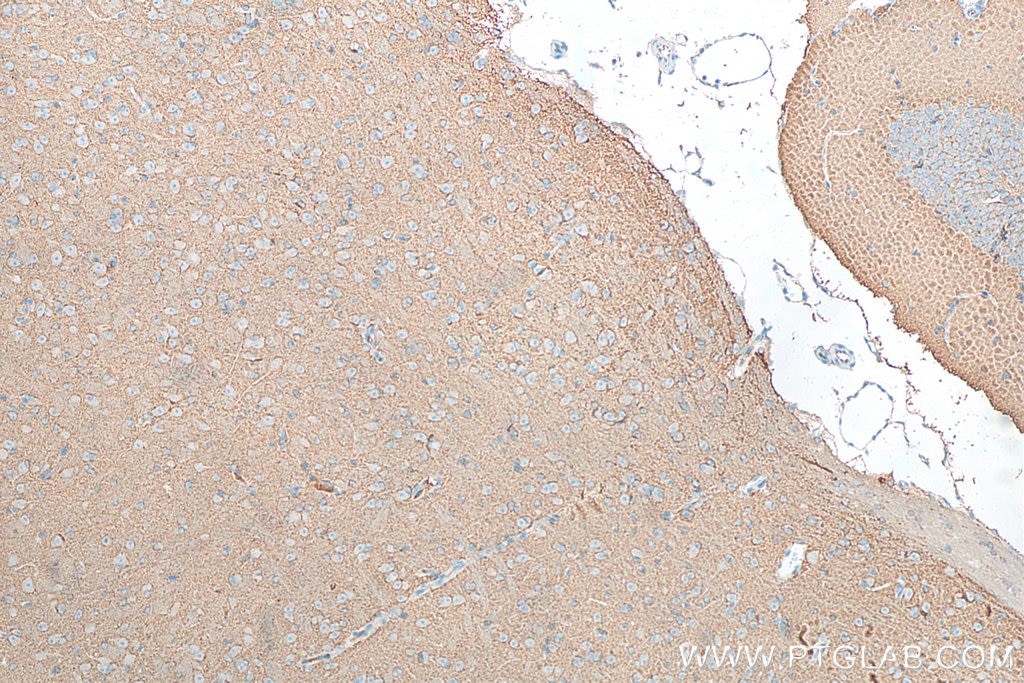 Immunohistochemistry (IHC) staining of mouse brain tissue using RAB3A Polyclonal antibody (15029-1-AP)