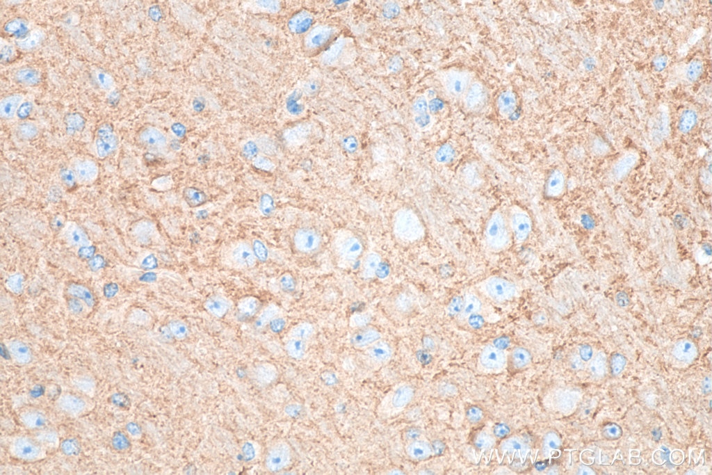 Immunohistochemistry (IHC) staining of mouse brain tissue using RAB3A Polyclonal antibody (15029-1-AP)